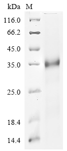 (Tris-Glycine gel) Discontinuous SDS-PAGE (reduced) with 5% enrichment gel and 15% separation gel.