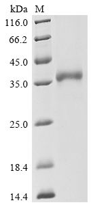 (Tris-Glycine gel) Discontinuous SDS-PAGE (reduced) with 5% enrichment gel and 15% separation gel.
