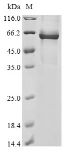 (Tris-Glycine gel) Discontinuous SDS-PAGE (reduced) with 5% enrichment gel and 15% separation gel. (Tris-Glycine gel) Discontinuous SDS-PAGE (reduced) with 5% enrichment gel and 15% separation gel.