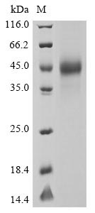 (Tris-Glycine gel) Discontinuous SDS-PAGE (reduced) with 5% enrichment gel and 15% separation gel.