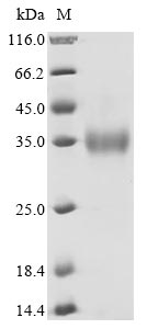(Tris-Glycine gel) Discontinuous SDS-PAGE (reduced) with 5% enrichment gel and 15% separation gel. (Tris-Glycine gel) Discontinuous SDS-PAGE (reduced) with 5% enrichment gel and 15% separation gel.