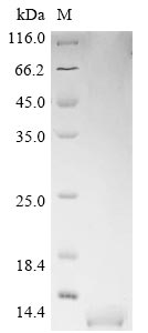 (Tris-Glycine gel) Discontinuous SDS-PAGE (reduced) with 5% enrichment gel and 15% separation gel.