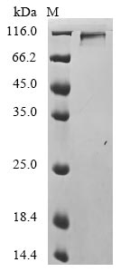 (Tris-Glycine gel) Discontinuous SDS-PAGE (reduced) with 5% enrichment gel and 15% separation gel. (Tris-Glycine gel) Discontinuous SDS-PAGE (reduced) with 5% enrichment gel and 15% separation gel.