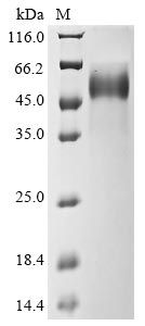 (Tris-Glycine gel) Discontinuous SDS-PAGE (reduced) with 5% enrichment gel and 15% separation gel. (Tris-Glycine gel) Discontinuous SDS-PAGE (reduced) with 5% enrichment gel and 15% separation gel.