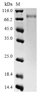 (Tris-Glycine gel) Discontinuous SDS-PAGE (reduced) with 5% enrichment gel and 15% separation gel. (Tris-Glycine gel) Discontinuous SDS-PAGE (reduced) with 5% enrichment gel and 15% separation gel.