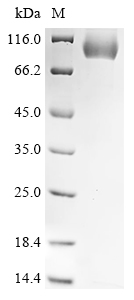 Recombinant Mouse Serine protease inhibitor A3K
(Serpina3k) - image 1