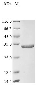 (Tris-Glycine gel) Discontinuous SDS-PAGE (reduced) with 5% enrichment gel and 15% separation gel. (Tris-Glycine gel) Discontinuous SDS-PAGE (reduced) with 5% enrichment gel and 15% separation gel.