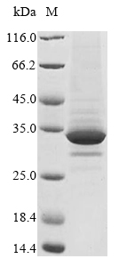 (Tris-Glycine gel) Discontinuous SDS-PAGE (reduced) with 5% enrichment gel and 15% separation gel. (Tris-Glycine gel) Discontinuous SDS-PAGE (reduced) with 5% enrichment gel and 15% separation gel.