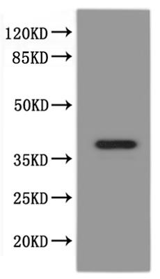 CSB-MP4672XBE is detected by Mouse anti-6*His monoclonal antibody.