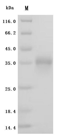 (Tris-Glycine gel) Discontinuous SDS-PAGE (reduced) with 5% enrichment gel and 15% separation gel.