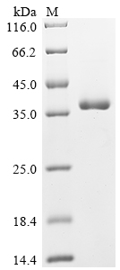 (Tris-Glycine gel) Discontinuous SDS-PAGE (reduced) with 5% enrichment gel and 15% separation gel.
