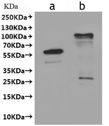 CSB-MP518991DOA(A4)is detected by Mouse anti-6*His monoclonal antibody.
