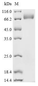 (Tris-Glycine gel) Discontinuous SDS-PAGE (reduced) with 5% enrichment gel and 15% separation gel. (Tris-Glycine gel) Discontinuous SDS-PAGE (reduced) with 5% enrichment gel and 15% separation gel.