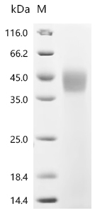 (Tris-Glycine gel) Discontinuous SDS-PAGE (reduced) with 5% enrichment gel and 15% separation gel.