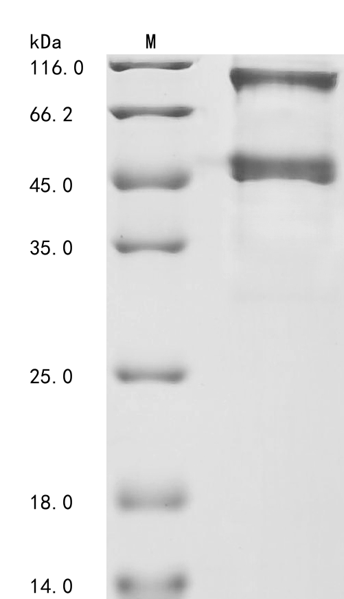 (Tris-Glycine gel) Discontinuous SDS-PAGE (reduced) with 5% enrichment gel and 15% separation gel. (Tris-Glycine gel) Discontinuous SDS-PAGE (reduced) with 5% enrichment gel and 15% separation gel.