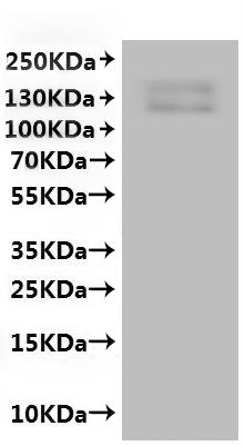 CSB-MP5880MOX(A4) is detected by Mouse anti-6*His monoclonal antibody.