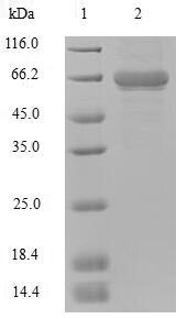 (Tris-Glycine gel) Discontinuous SDS-PAGE (reduced) with 5% enrichment gel and 15% separation gel. (Tris-Glycine gel) Discontinuous SDS-PAGE (reduced) with 5% enrichment gel and 15% separation gel.