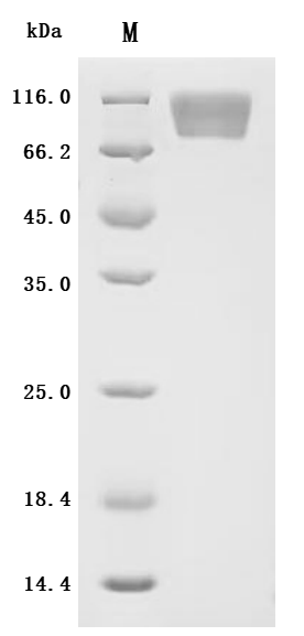 (Tris-Glycine gel) Discontinuous SDS-PAGE (reduced) with 5% enrichment gel and 15% separation gel.