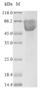 (Tris-Glycine gel) Discontinuous SDS-PAGE (reduced) with 5% enrichment gel and 15% separation gel. (Tris-Glycine gel) Discontinuous SDS-PAGE (reduced) with 5% enrichment gel and 15% separation gel.