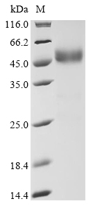 (Tris-Glycine gel) Discontinuous SDS-PAGE (reduced) with 5% enrichment gel and 15% separation gel. (Tris-Glycine gel) Discontinuous SDS-PAGE (reduced) with 5% enrichment gel and 15% separation gel.