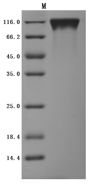 CSB-MP621519HU-SDS