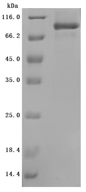 CSB-MP622752HU SDS-PAGE