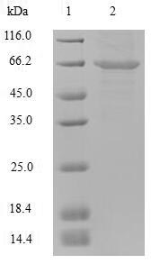 (Tris-Glycine gel) Discontinuous SDS-PAGE (reduced) with 5% enrichment gel and 15% separation gel. (Tris-Glycine gel) Discontinuous SDS-PAGE (reduced) with 5% enrichment gel and 15% separation gel.