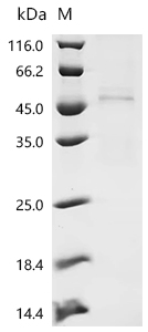 (Tris-Glycine gel) Discontinuous SDS-PAGE (reduced) with 5% enrichment gel and 15% separation gel.