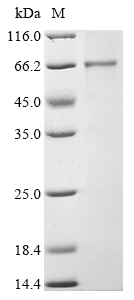 (Tris-Glycine gel) Discontinuous SDS-PAGE (reduced) with 5% enrichment gel and 15% separation gel. (Tris-Glycine gel) Discontinuous SDS-PAGE (reduced) with 5% enrichment gel and 15% separation gel.