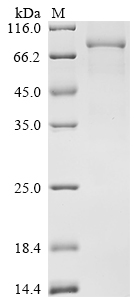 Recombinant Mouse Neuronal pentraXIn-1 (Nptx1) , partial - image 1