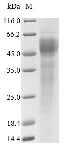 SDS-PAGE- Recombinant protein Human FCRL6
