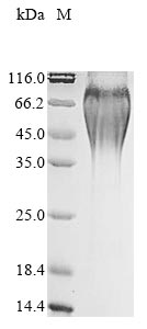 (Tris-Glycine gel) Discontinuous SDS-PAGE (reduced) with 5% enrichment gel and 15% separation gel. (Tris-Glycine gel) Discontinuous SDS-PAGE (reduced) with 5% enrichment gel and 15% separation gel.