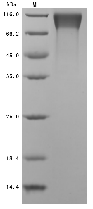 (Tris-Glycine gel) Discontinuous SDS-PAGE (reduced) with 5% enrichment gel and 15% separation gel.