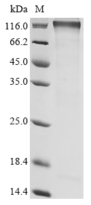 Recombinant Mouse Semaphorin-4C (Sema4c) , partial - image 1