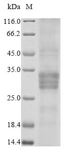 (Tris-Glycine gel) Discontinuous SDS-PAGE (reduced) with 5% enrichment gel and 15% separation gel. (Tris-Glycine gel) Discontinuous SDS-PAGE (reduced) with 5% enrichment gel and 15% separation gel.