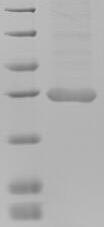 (Tris-Glycine gel) Discontinuous SDS-PAGE (reduced) with 5% enrichment gel and 15% separation gel. (Tris-Glycine gel) Discontinuous SDS-PAGE (reduced) with 5% enrichment gel and 15% separation gel.