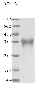 (Tris-Glycine gel) Discontinuous SDS-PAGE (reduced) with 5% enrichment gel and 15% separation gel. (Tris-Glycine gel) Discontinuous SDS-PAGE (reduced) with 5% enrichment gel and 15% separation gel.
