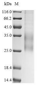 (Tris-Glycine gel) Discontinuous SDS-PAGE (reduced) with 5% enrichment gel and 15% separation gel. (Tris-Glycine gel) Discontinuous SDS-PAGE (reduced) with 5% enrichment gel and 15% separation gel.
