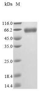 (Tris-Glycine gel) Discontinuous SDS-PAGE (reduced) with 5% enrichment gel and 15% separation gel. (Tris-Glycine gel) Discontinuous SDS-PAGE (reduced) with 5% enrichment gel and 15% separation gel.