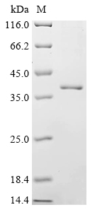 (Tris-Glycine gel) Discontinuous SDS-PAGE (reduced) with 5% enrichment gel and 15% separation gel.