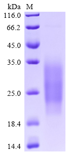 CSB-MP743558HU SDS-PAGE