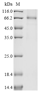 (Tris-Glycine gel) Discontinuous SDS-PAGE (reduced) with 5% enrichment gel and 15% separation gel. (Tris-Glycine gel) Discontinuous SDS-PAGE (reduced) with 5% enrichment gel and 15% separation gel.
