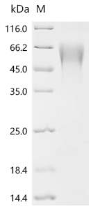 (Tris-Glycine gel) Discontinuous SDS-PAGE (reduced) with 5% enrichment gel and 15% separation gel.