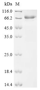 (Tris-Glycine gel) Discontinuous SDS-PAGE (reduced) with 5% enrichment gel and 15% separation gel. (Tris-Glycine gel) Discontinuous SDS-PAGE (reduced) with 5% enrichment gel and 15% separation gel.