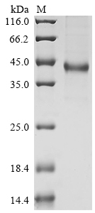 (Tris-Glycine gel) Discontinuous SDS-PAGE (reduced) with 5% enrichment gel and 15% separation gel. (Tris-Glycine gel) Discontinuous SDS-PAGE (reduced) with 5% enrichment gel and 15% separation gel.