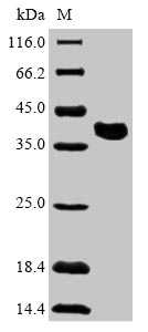 (Tris-Glycine gel) Discontinuous SDS-PAGE (reduced) with 5% enrichment gel and 15% separation gel. (Tris-Glycine gel) Discontinuous SDS-PAGE (reduced) with 5% enrichment gel and 15% separation gel.