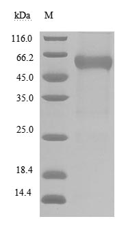 (Tris-Glycine gel) Discontinuous SDS-PAGE (reduced) with 5% enrichment gel and 15% separation gel. (Tris-Glycine gel) Discontinuous SDS-PAGE (reduced) with 5% enrichment gel and 15% separation gel.