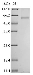 (Tris-Glycine gel) Discontinuous SDS-PAGE (reduced) with 5% enrichment gel and 15% separation gel. (Tris-Glycine gel) Discontinuous SDS-PAGE (reduced) with 5% enrichment gel and 15% separation gel.