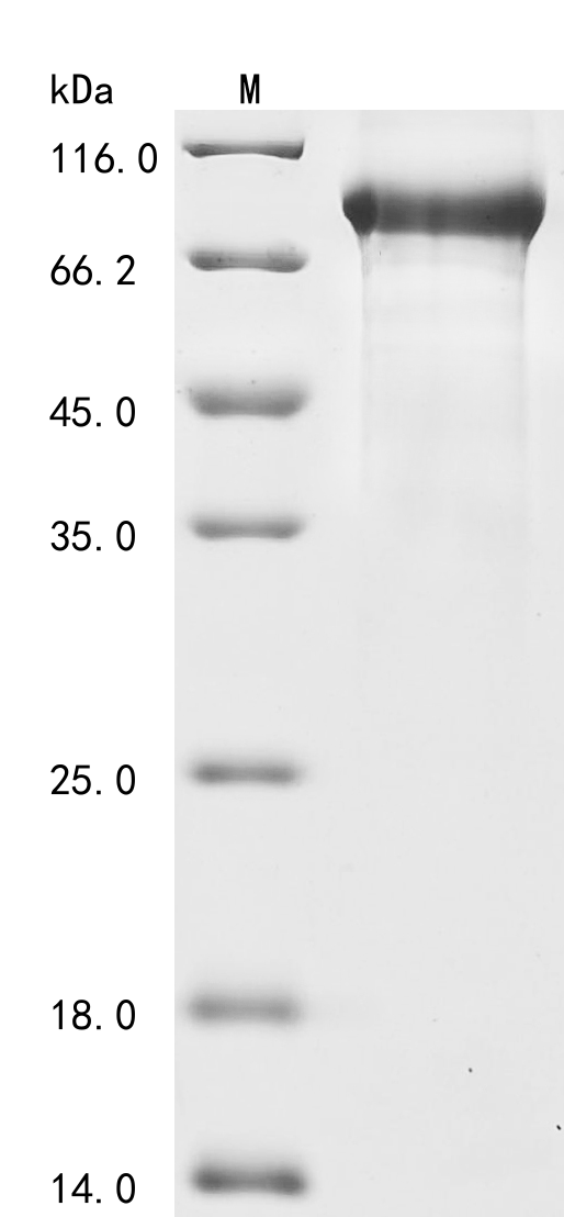 (Tris-Glycine gel) Discontinuous SDS-PAGE (reduced) with 5% enrichment gel and 15% separation gel. (Tris-Glycine gel) Discontinuous SDS-PAGE (reduced) with 5% enrichment gel and 15% separation gel.
