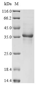 (Tris-Glycine gel) Discontinuous SDS-PAGE (reduced) with 5% enrichment gel and 15% separation gel. (Tris-Glycine gel) Discontinuous SDS-PAGE (reduced) with 5% enrichment gel and 15% separation gel.